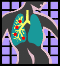 Pleural mesothelioma